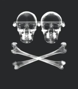 Orbital Band