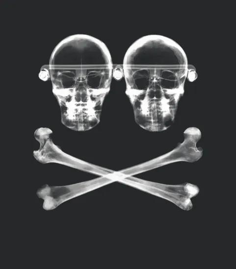 Orbital Band